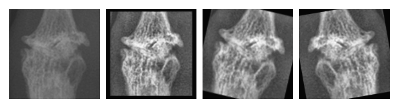 augmentations