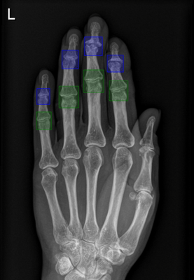 hand