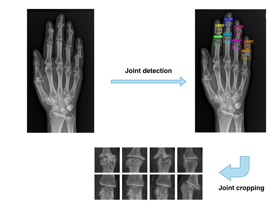 joint-detection-process
