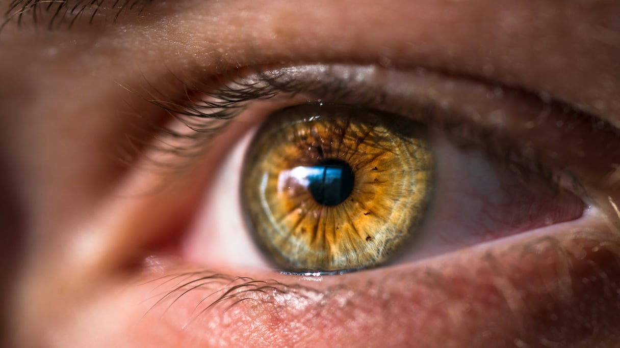 Eye. Photo by Joel Staveley on Unsplash